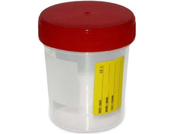 10x Contenitori per Urina con Tappo Ermetico a Vite 120ml Analisi Urine...