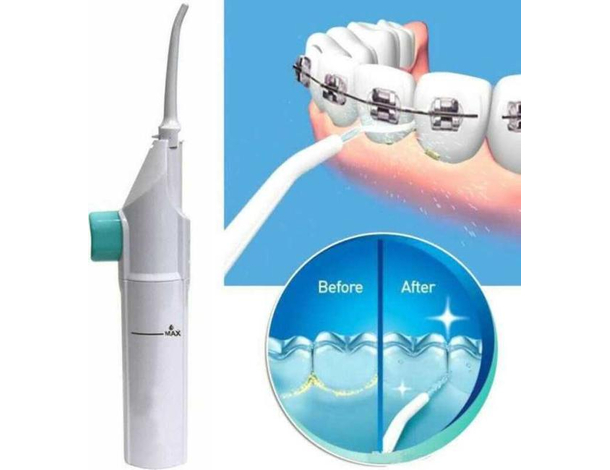Idropulsore Dentale Portatile per Pulizia Denti Igiene Orale Irrigatore Bocca