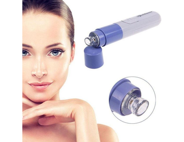 Aspiratore Pulitore Facciale per Pori Viso e Naso Punti Neri a Batteria