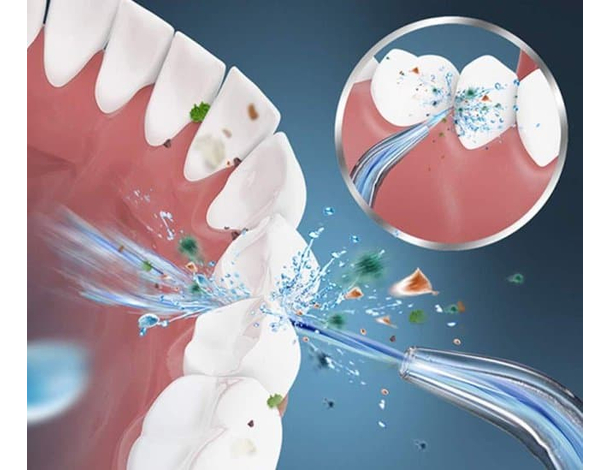 Idropulsore Dentale USB Professionale Irrigatore Orale Elettrico Denti...